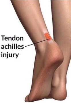 Kentucky Horsewear Kentucky Achilles Gel Socks 11 Kentucky Horsewear Kentucky Achilles Gel Socks -Equestrian Supplie Shop Tendon Injury Graphs 1280x1280